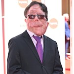Adam Pearson 'beyond honoured' to star in Elephant Man remake
